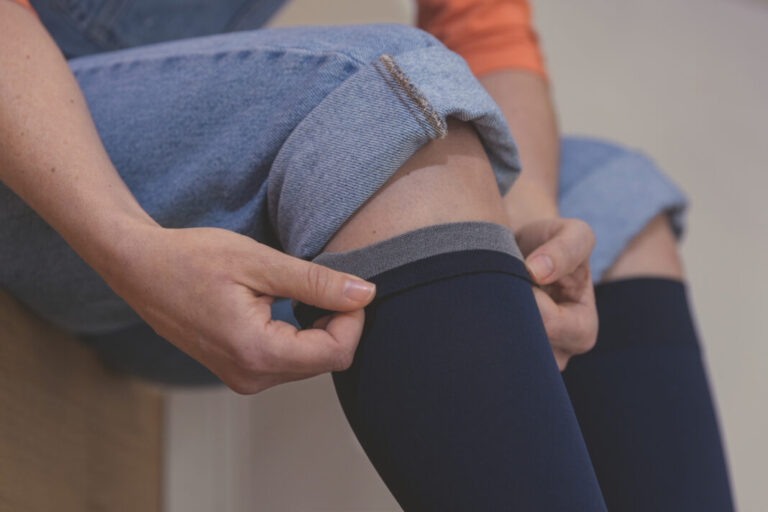 Más de 17% de los hombres padecen várices